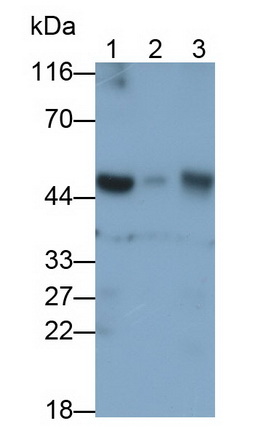 Polyclonal Antibody to Alanine Glyoxylate Aminotransferase (AGXT)