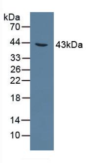 Polyclonal Antibody to Alanine Glyoxylate Aminotransferase (AGXT)