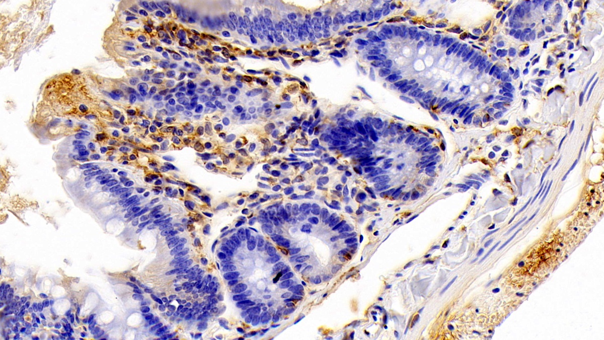 Polyclonal Antibody to Ionized Calcium-binding Adapter Molecule 1 (IBA1)