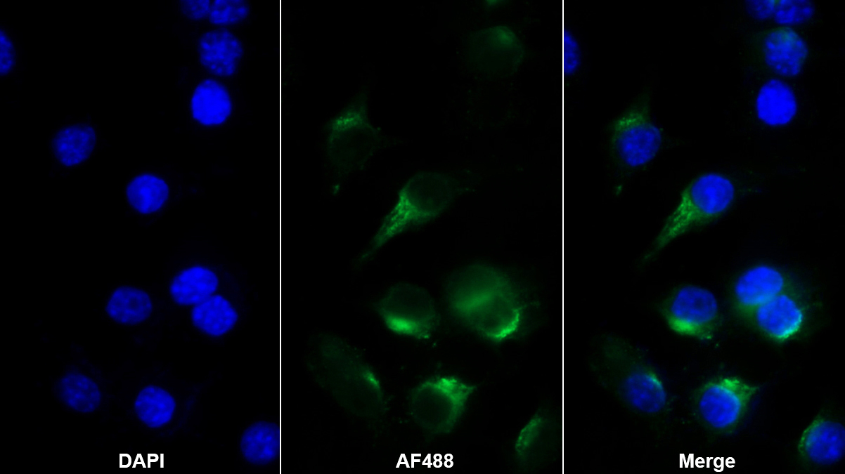 Polyclonal Antibody to Allograft inflammatory factor 1 (AIF1)