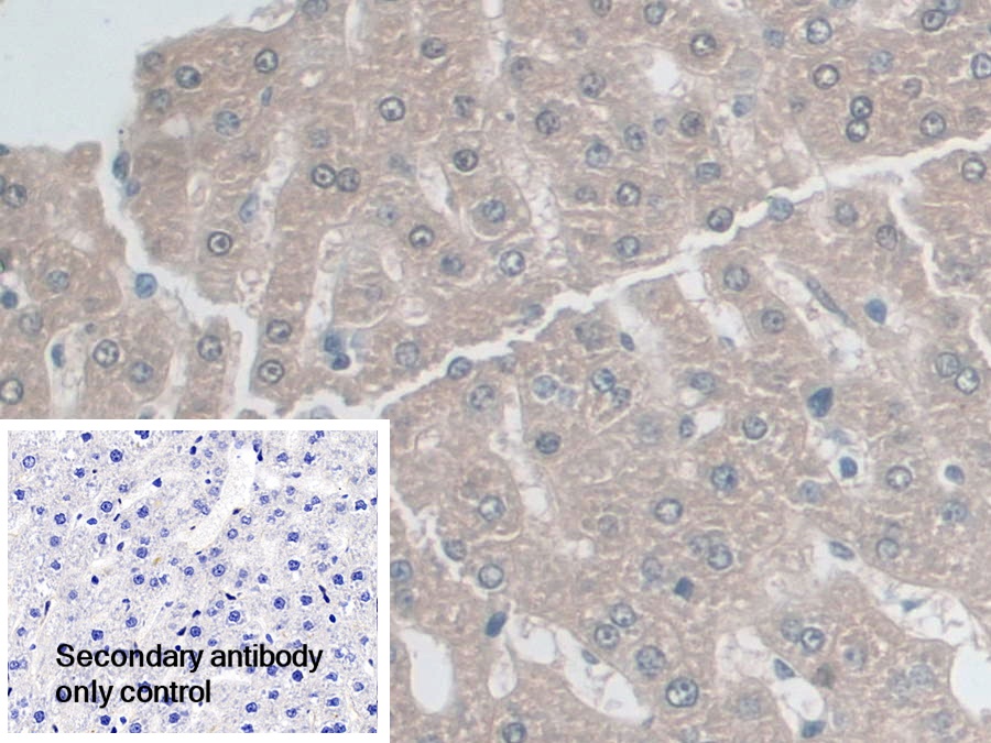 Polyclonal Antibody to Adenylate Kinase 2 (AK2)