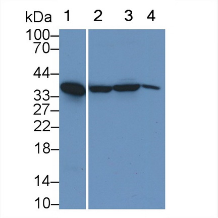 Polyclonal Antibody to Aminolevulinate Delta Dehydratase (ALAD)