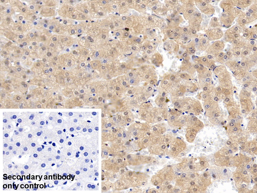 Polyclonal Antibody to Aminolevulinate Delta Dehydratase (ALAD)