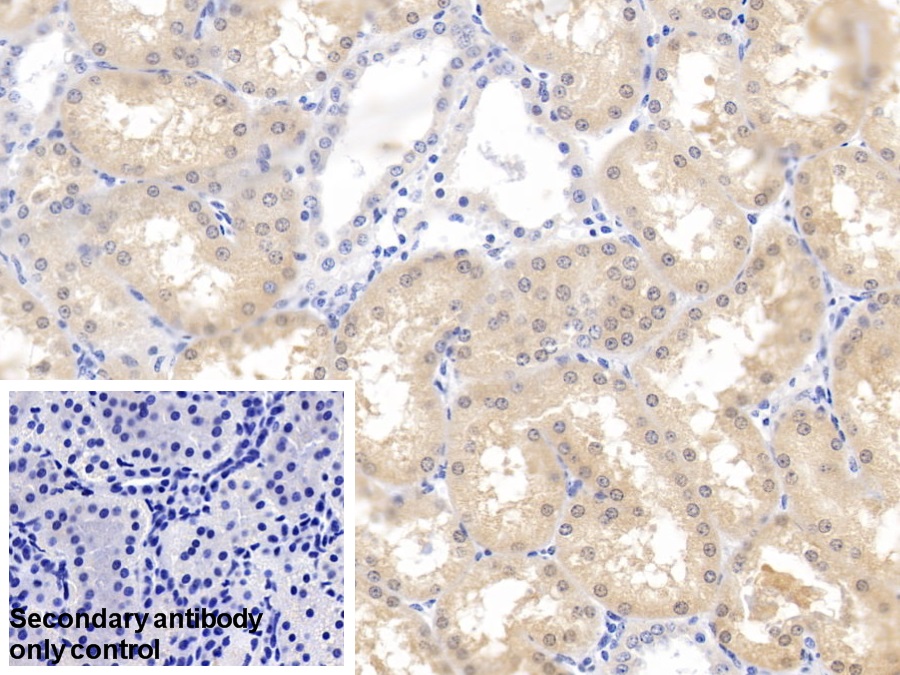 Polyclonal Antibody to Aminolevulinate Delta Dehydratase (ALAD)