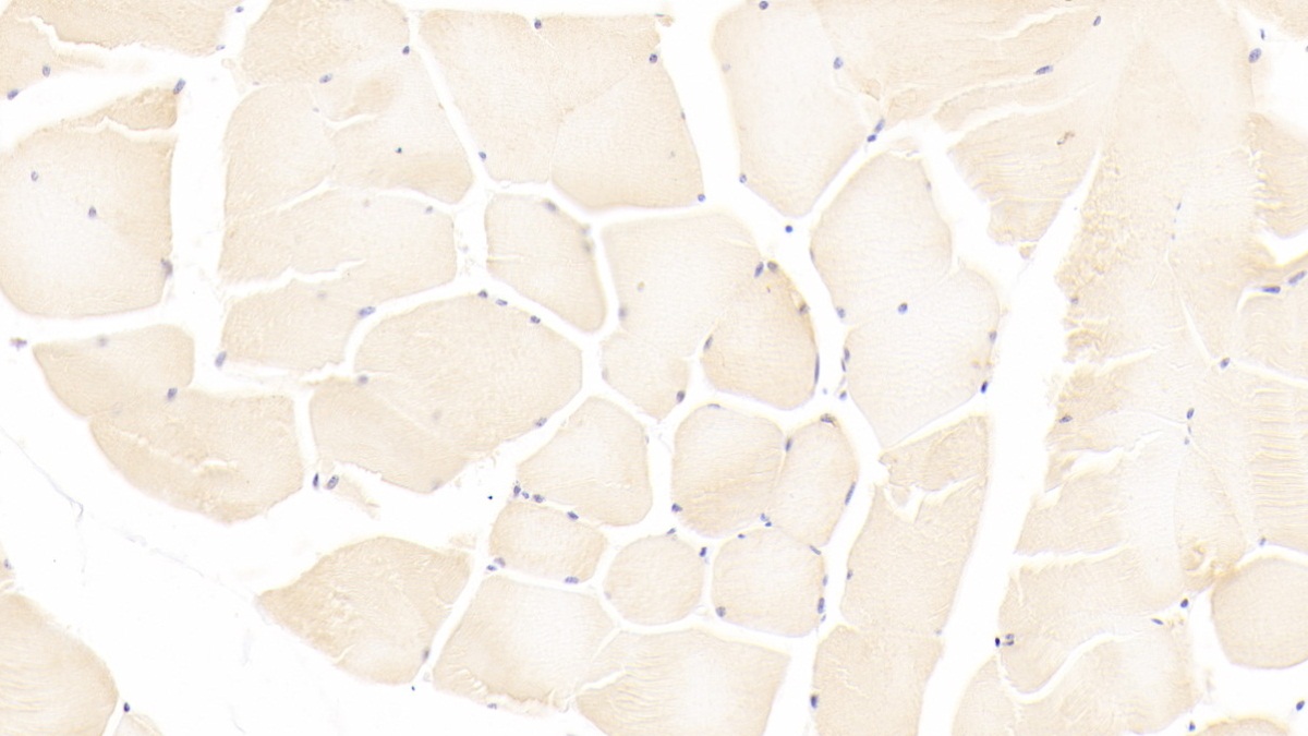 Polyclonal Antibody to Autocrine Motility Factor Receptor (AMFR)