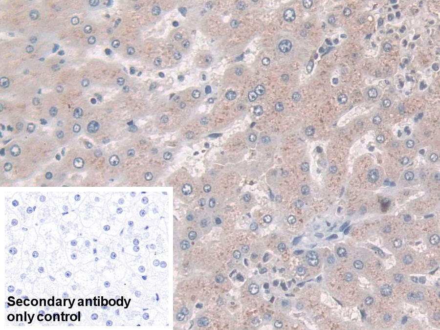 Polyclonal Antibody to N-Acylsphingosine Amidohydrolase 1 (ASAH1)