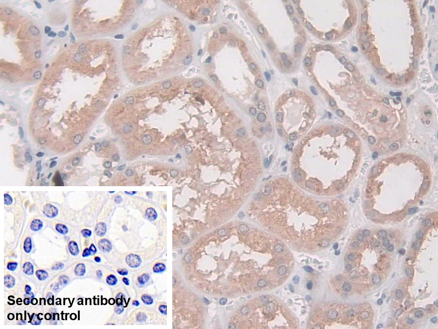 Polyclonal Antibody to N-Acylsphingosine Amidohydrolase 1 (ASAH1)