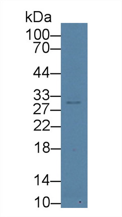 Polyclonal Antibody to Aurora Kinase C (AURKC)