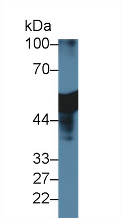 Polyclonal Antibody to Antithrombin (AT)