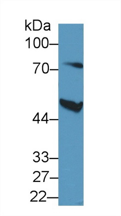 Polyclonal Antibody to Antithrombin (AT)