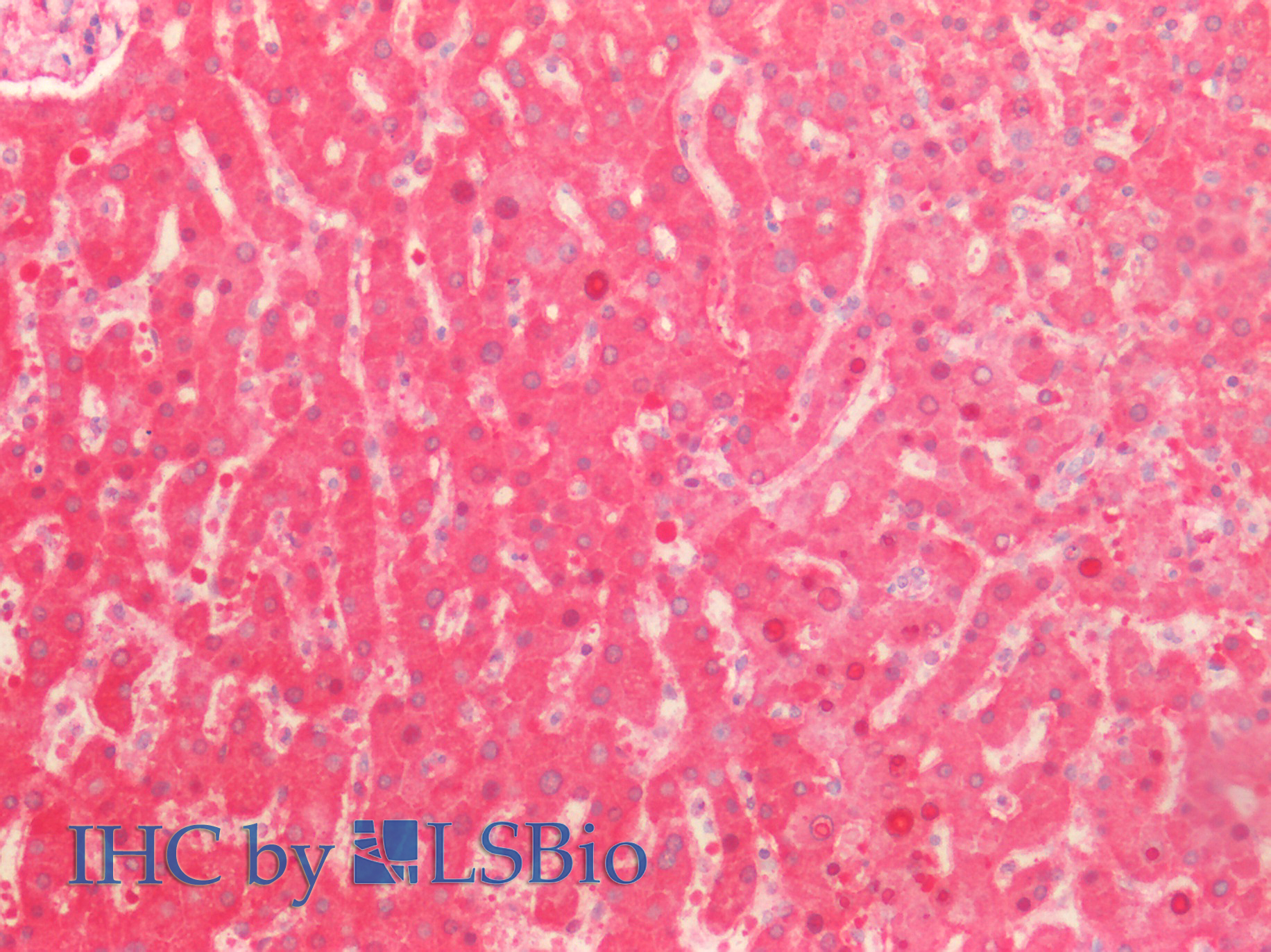 Polyclonal Antibody to Antithrombin (AT)