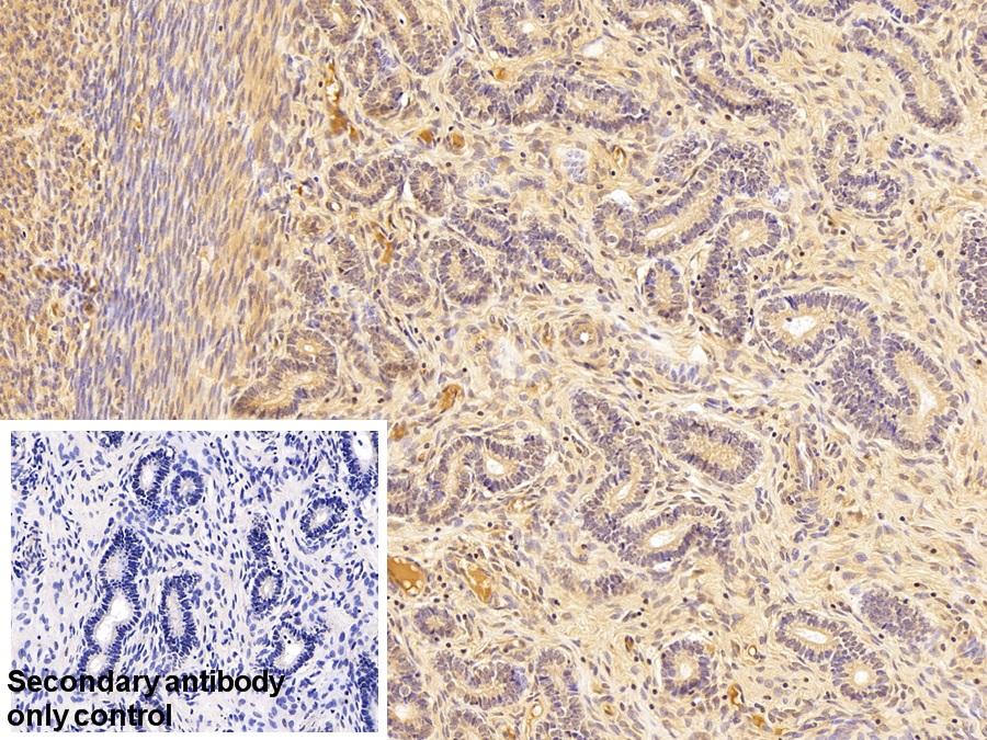 Polyclonal Antibody to Antithrombin (AT)