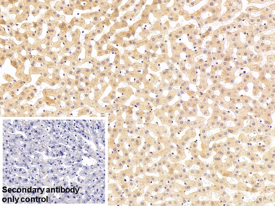 Polyclonal Antibody to Antithrombin (AT)