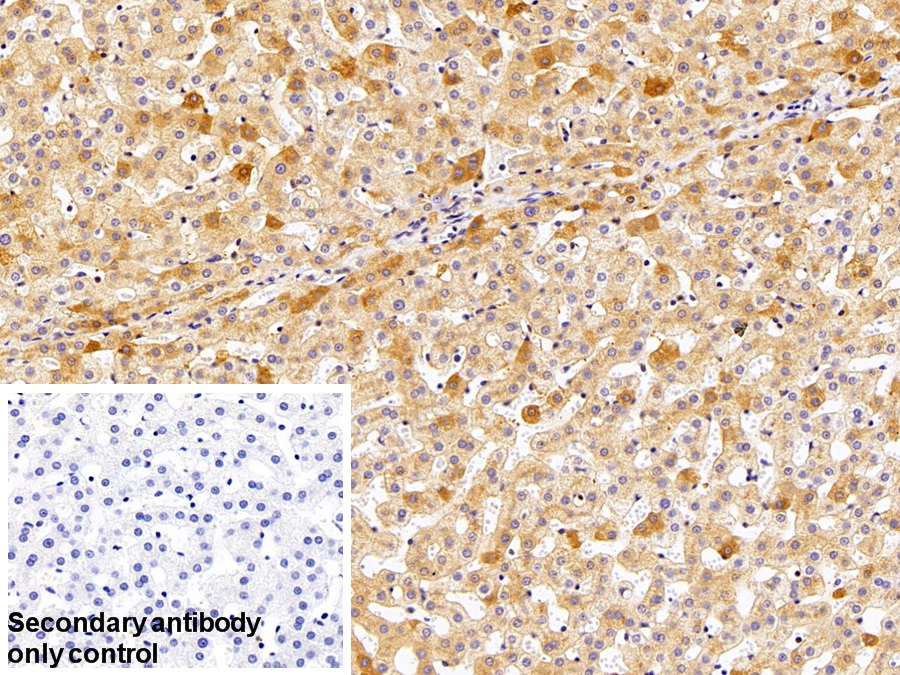 Polyclonal Antibody to Antithrombin (AT)