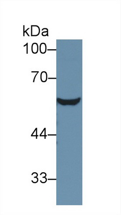 Polyclonal Antibody to Antithrombin (AT)