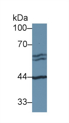 Polyclonal Antibody to Antithrombin (AT)