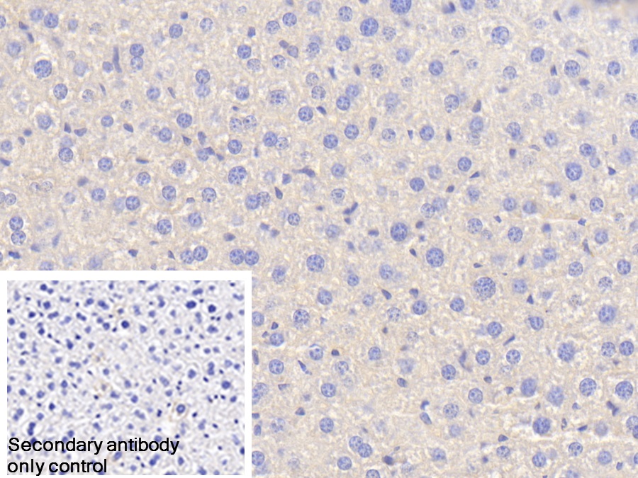 Polyclonal Antibody to Antithrombin (AT)