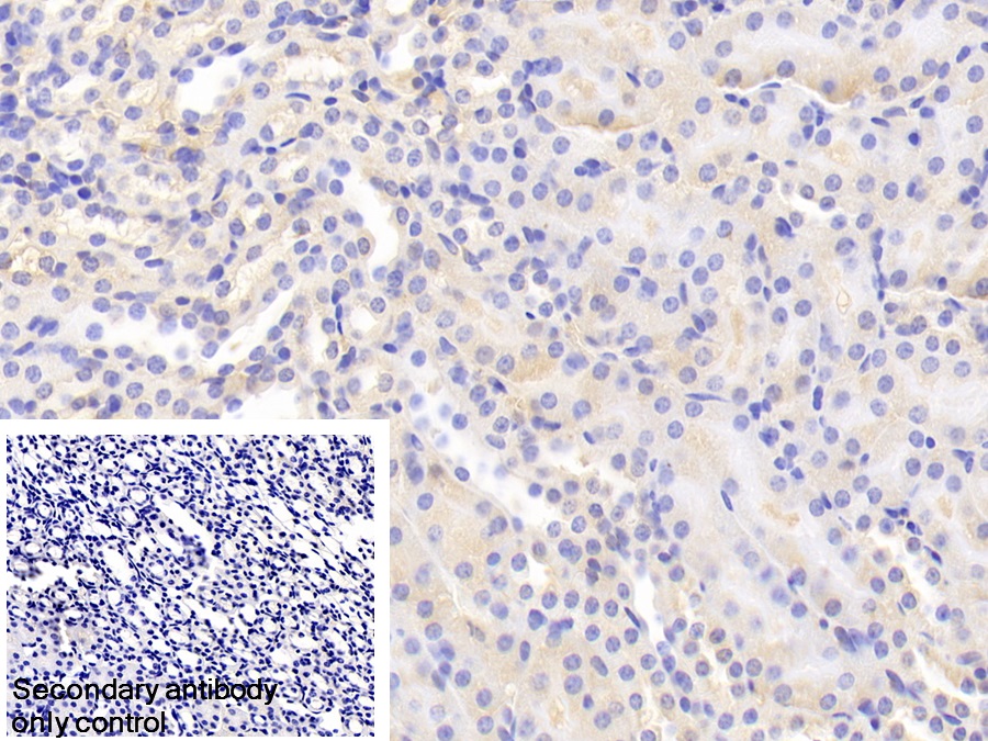 Polyclonal Antibody to Antithrombin (AT)