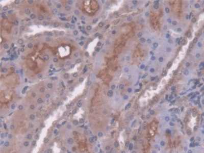 Polyclonal Antibody to Antithrombin (AT)