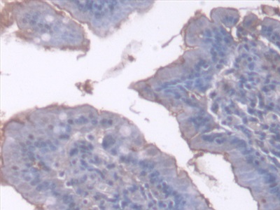 Polyclonal Antibody to Antithrombin (AT)