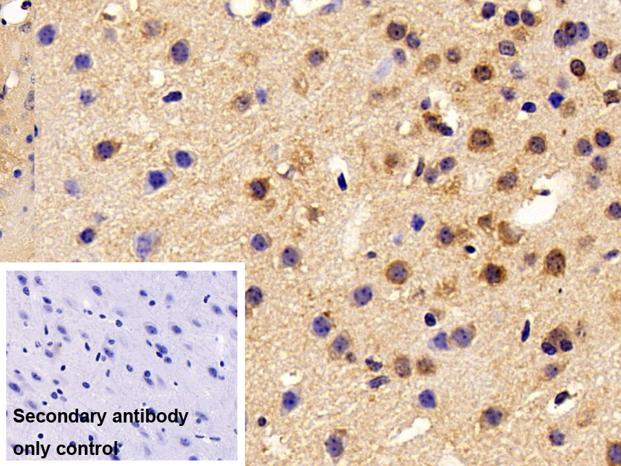 Polyclonal Antibody to Adenomatosis Polyposis Coli Protein (APC)