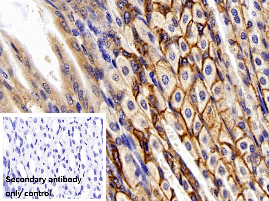 Polyclonal Antibody to Adenomatosis Polyposis Coli Protein (APC)