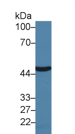 Polyclonal Antibody to Argininosuccinate Synthetase 1 (ASS1)