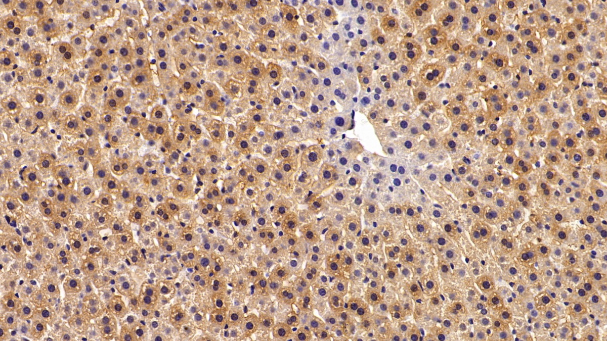 Polyclonal Antibody to Argininosuccinate Synthetase 1 (ASS1)