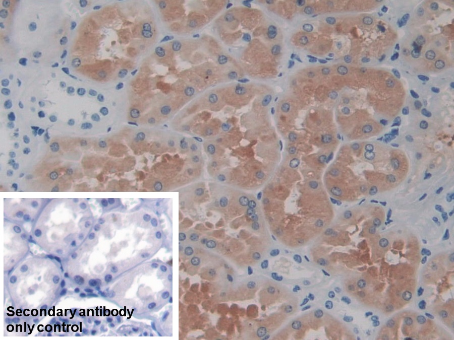 Polyclonal Antibody to Argininosuccinate Synthetase 1 (ASS1)