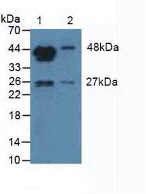 Polyclonal Antibody to Aromatase (ARO)