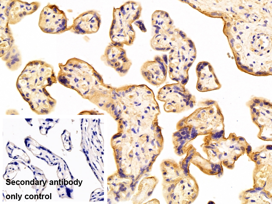 Polyclonal Antibody to Aromatase (ARO)