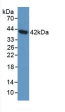 Polyclonal Antibody to Aspartylglucosaminidase (AGA)