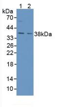 Polyclonal Antibody to Aspartylglucosaminidase (AGA)