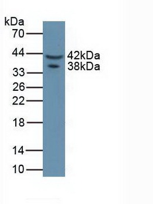 Polyclonal Antibody to Asporin (ASPN)