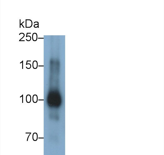 Polyclonal Antibody to Ectonucleotide Pyrophosphatase/Phosphodiesterase 2 (ENPP2)