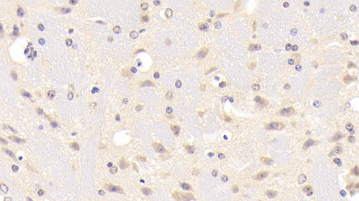 Polyclonal Antibody to B-Cell CLL/Lymphoma 10 (Bcl10)