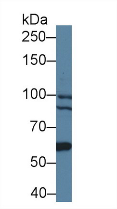 Polyclonal Antibody to Bcl6 Corepressor (BCOR)