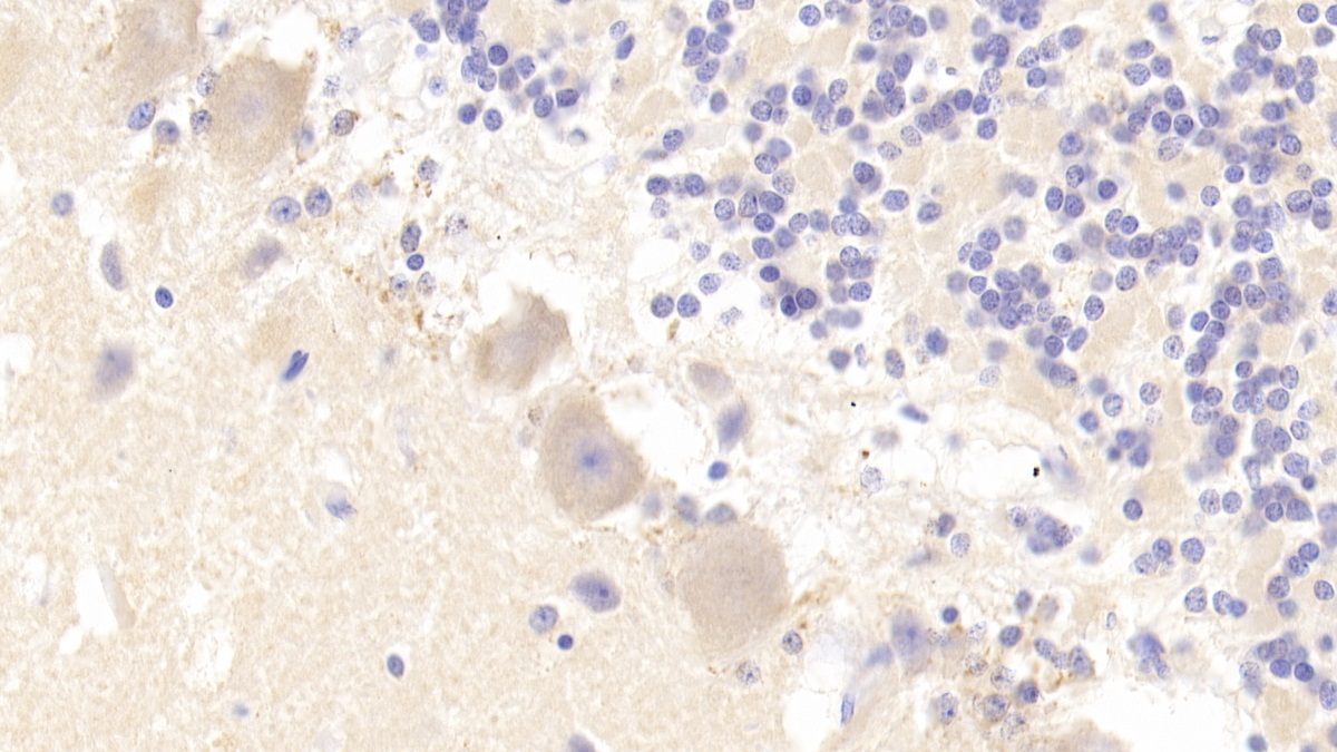 Polyclonal Antibody to Breakpoint Cluster Region (BCR)