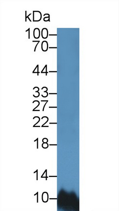 Polyclonal Antibody to Barrier To Autointegration Factor 1 (BANF1)