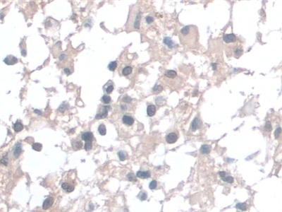 Polyclonal Antibody to Barrier To Autointegration Factor 1 (BANF1)