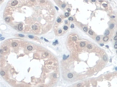 Polyclonal Antibody to Barrier To Autointegration Factor 1 (BANF1)