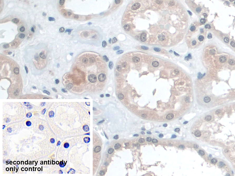 Polyclonal Antibody to Barrier To Autointegration Factor 1 (BANF1)