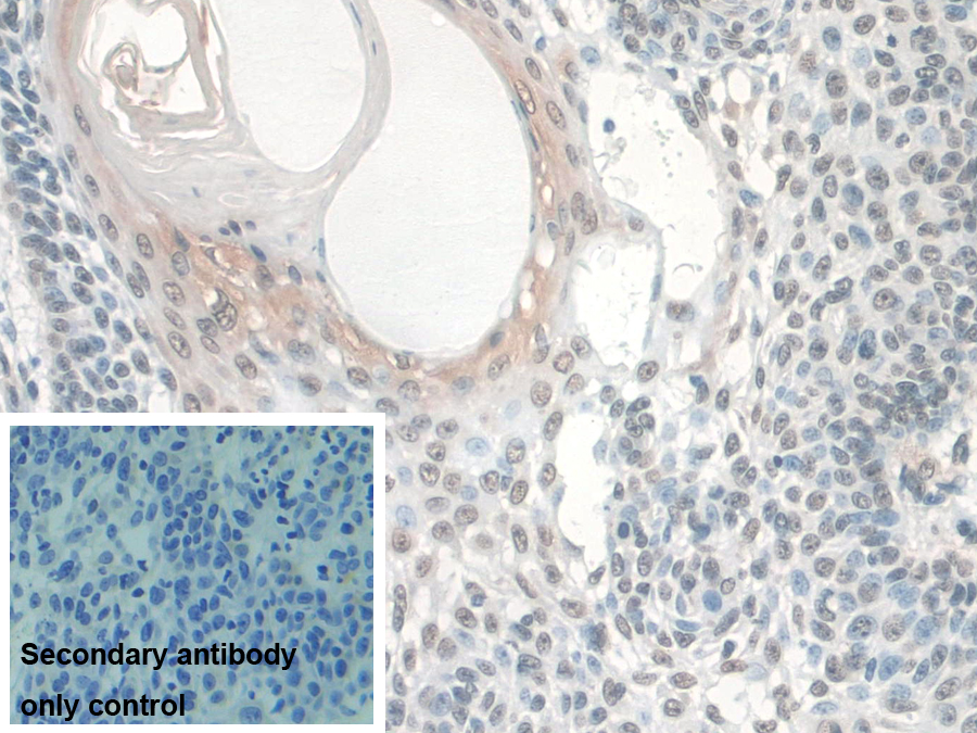 Polyclonal Antibody to Barrier To Autointegration Factor 1 (BANF1)