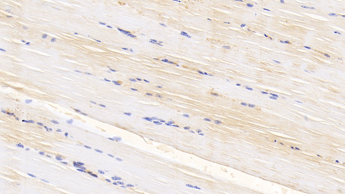 Polyclonal Antibody to Caspase 6 (CASP6)