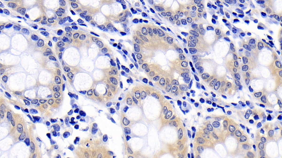 Polyclonal Antibody to Caspase 6 (CASP6)