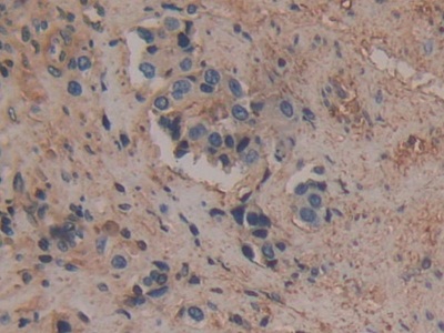 Polyclonal Antibody to Annexin A6 (ANXA6)