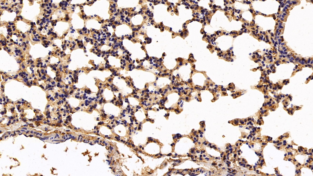 Polyclonal Antibody to Annexin A6 (ANXA6)