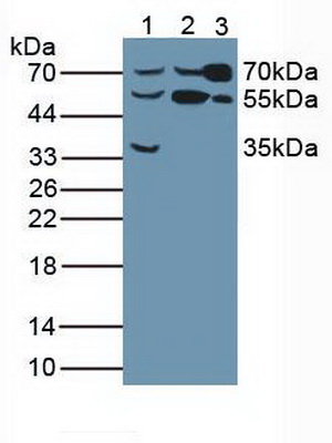 Polyclonal Antibody to Butyrylcholinesterase (BCHE)