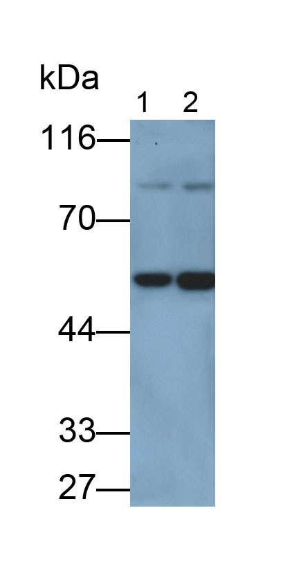 Polyclonal Antibody to Butyrylcholinesterase (BCHE)