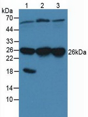 Polyclonal Antibody to Calcyclin Binding Protein (CACYBP)